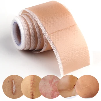 Эффективный силиконовый гелевый пластырь для удаления шрамов - медицинская лента для лечения акне, ожогов и травм.